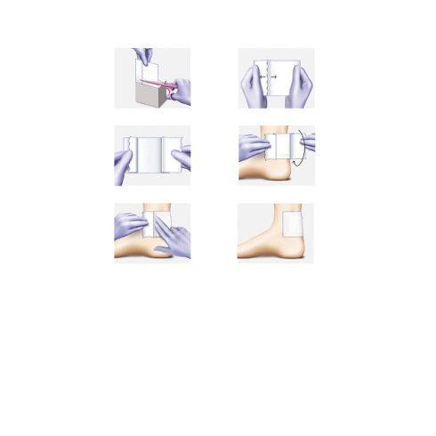 Omnifix® Elastic rögzítőflísz (30 cm x 10 m) - tekercses