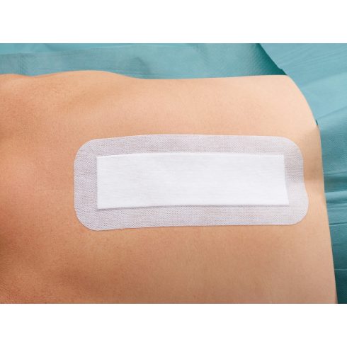 Cosmopor® E steril szigetkötszer (10x6 cm) - 25 db / csomag