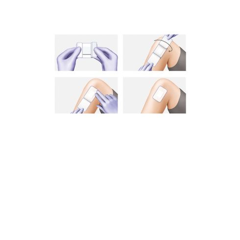 Cosmopor® E steril szigetkötszer (15x8 cm) - 25 db / csomag